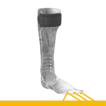 afbeelding ORTEAM Enkel-Voet Orthesen